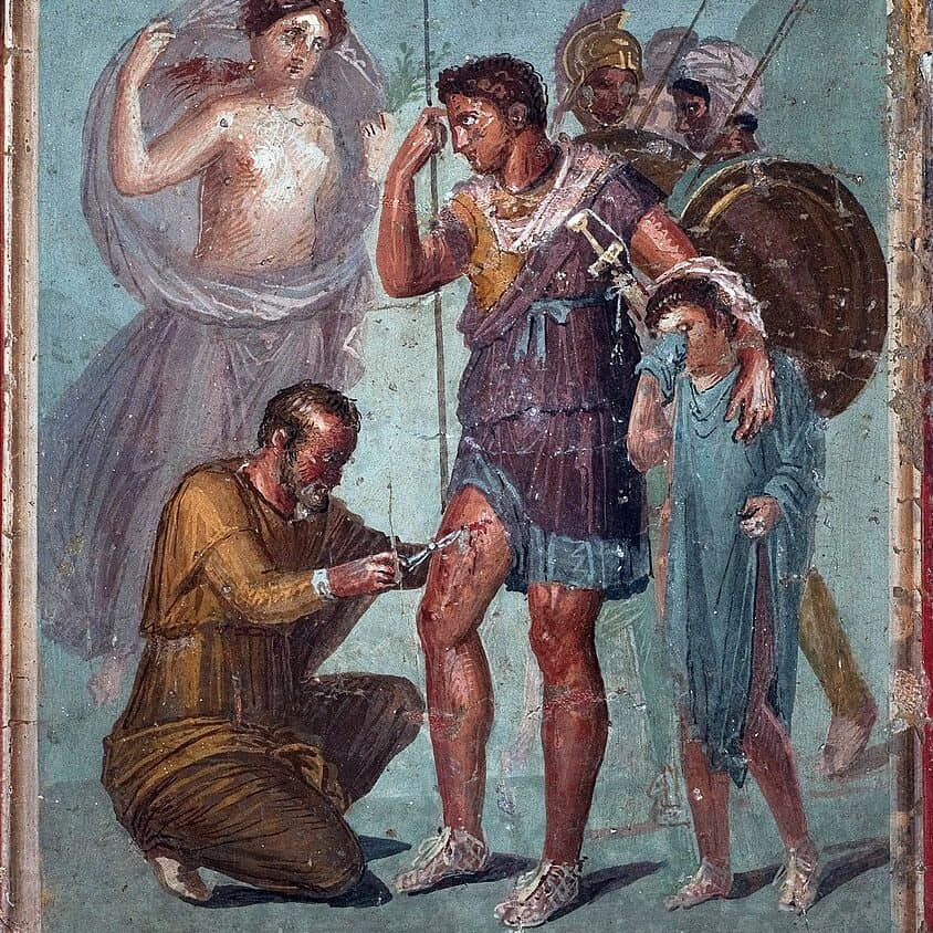 Fresque de Pompéi - Le soigneur Iapyx retire une pointe de flèche de la jambe d’Énée