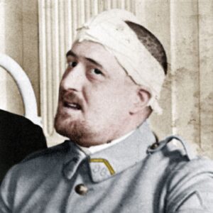 Guillaume Apollinaire, avec un bandage sur la tête (mai 1916) - photo colorisée