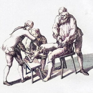 La torture des brodequins, Codex theresianus (Autriche, 1768)