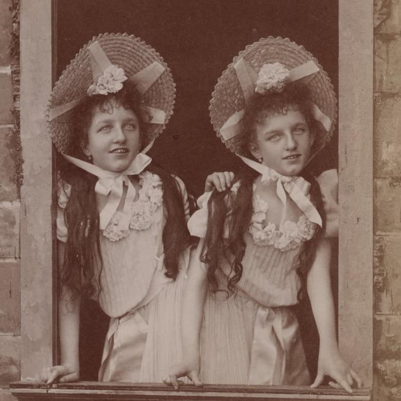 Rosa et Josepha, sœurs siamoises, atelier Nadar (XIXe)